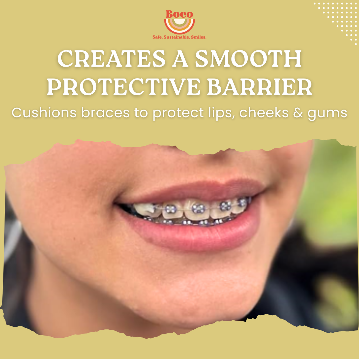 Ortho Wax (ORIGINAL HONEY) – Natural Braces Protection Orthodontic Wax (75 Buttons)